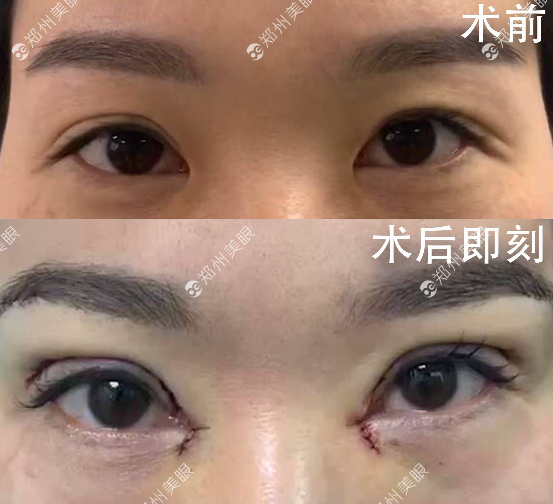 怎样恢复圆头凤眼数据(兄弟9820凤眼计数器怎么清零？)