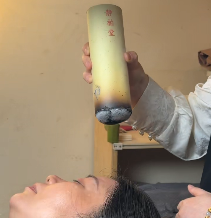 静柏堂古法艾灸_悬灸手法